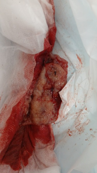 Brown discharge and light bleeding at 12 weeks, worried about pregnancy loss *[images included]