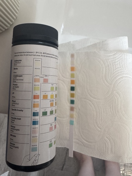 Finished seven days of nitrofurantoin, does this look clear now?