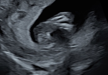 Boy or girl?