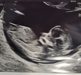 Gender Guess! Boy or Girl