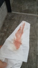 Brown discharge and light bleeding at 12 weeks, worried about pregnancy loss