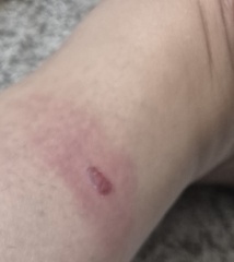 Best DEET repellent for avoiding insect bites while travelling in Europe