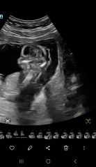Gender 14 weeks GUESS