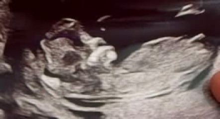 “Confirmed” nub theories