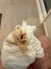 Mucus plug? Irritated cervix? Or bloody show? **PHOTOS**