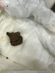 Does my toddler have worms??