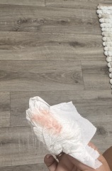 Light pink spotting after progesterone pessaries and blood thinners in pregnancy