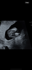 Boy or girl?