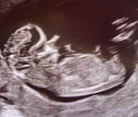 Boy or girl guesses?