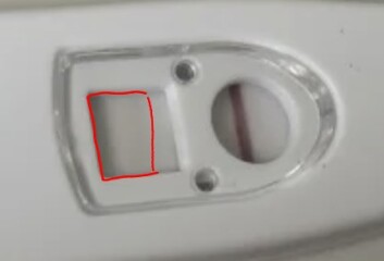 Line eye?! Omg please help currently walking about house crying. Is this positive