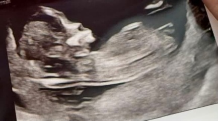 “Confirmed” nub theories