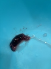 Could this be a miscarriage or another early pregnancy issue?
