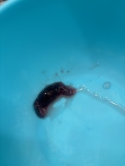 Could this be a miscarriage or another early pregnancy issue?