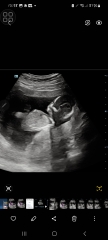 Gender 14 weeks GUESS