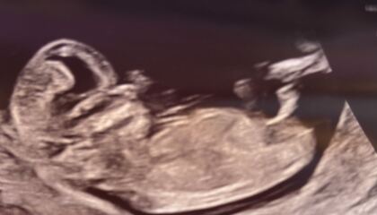 Nub theory, boy or girl?