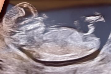 Boy or girl guesses?