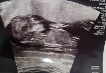 Gender Guess! Boy or Girl