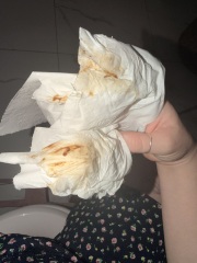 Mucus plug? Irritated cervix? Or bloody show? **PHOTOS**