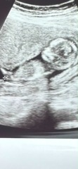 Nub theory guesses anyone? 13w 💙🩷