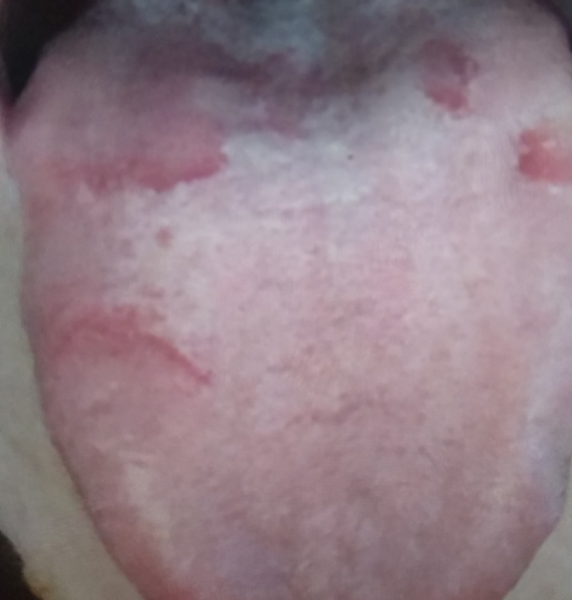 Could my issues be a B12 problem? GP is not interested.