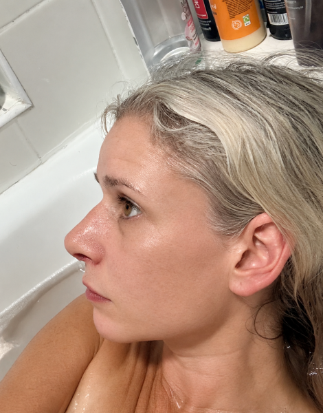 I’ve just had a nose job in Turkey - AMA