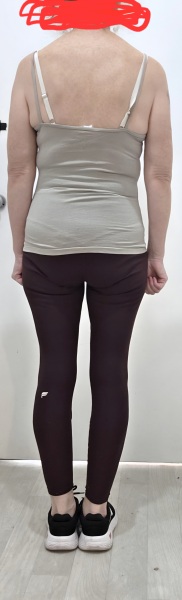 Is there a change in size or shape in theses photos?