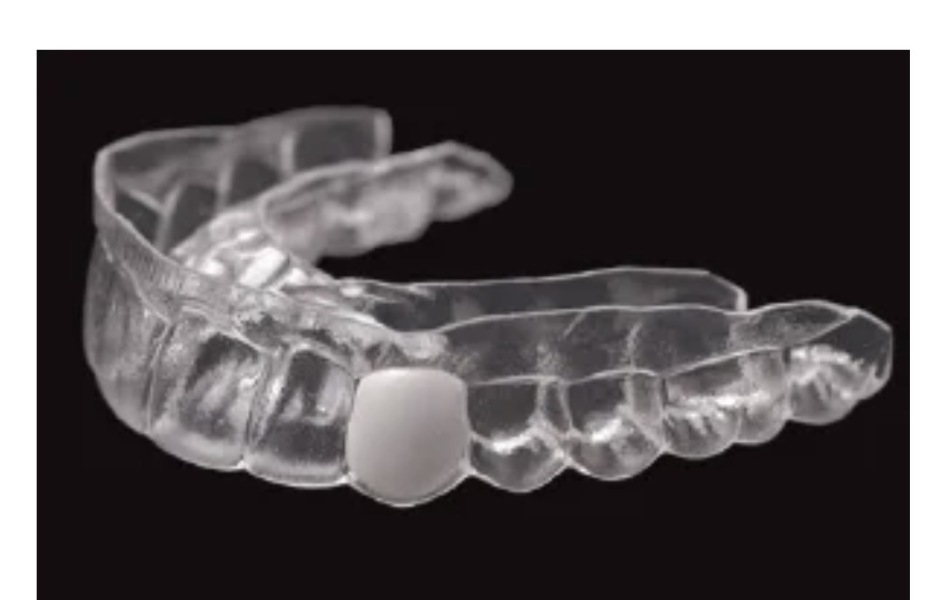 AIBU to feel unable to cope with an immediate denture? Any suggestions?
