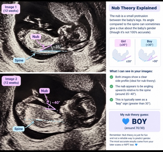 Has ChatGPT misread the nub theory for my pregnancy scan?