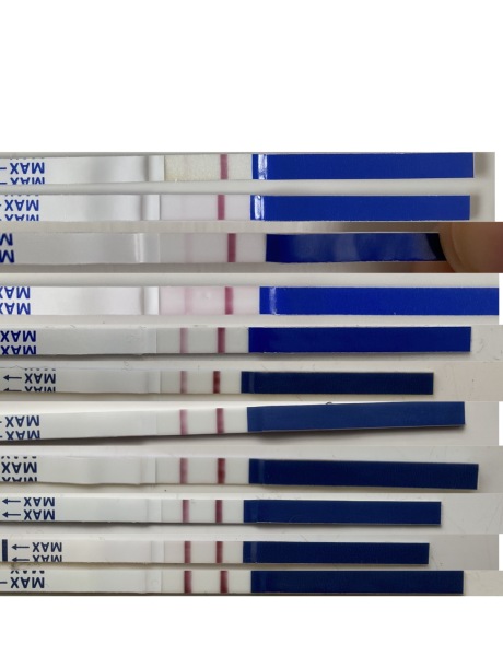 Very early pregnancy spotting after previous losses, very anxious , worth contacting EPU?