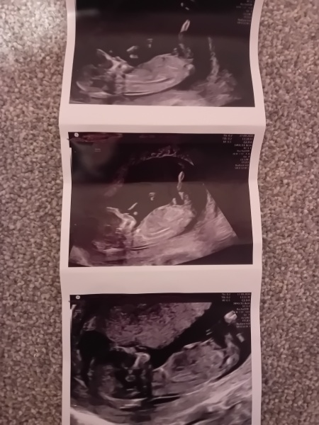 Guesses on gender?