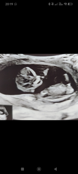 Boy or girl?