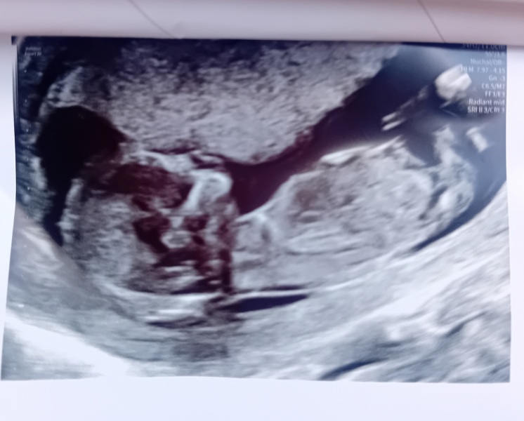 Any guesses on gender?