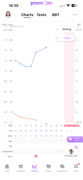 BBT charts.. 10dpo is there still hope?