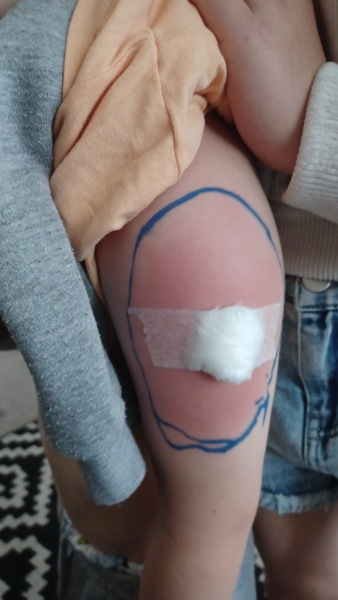 Reaction after pre school vaccines