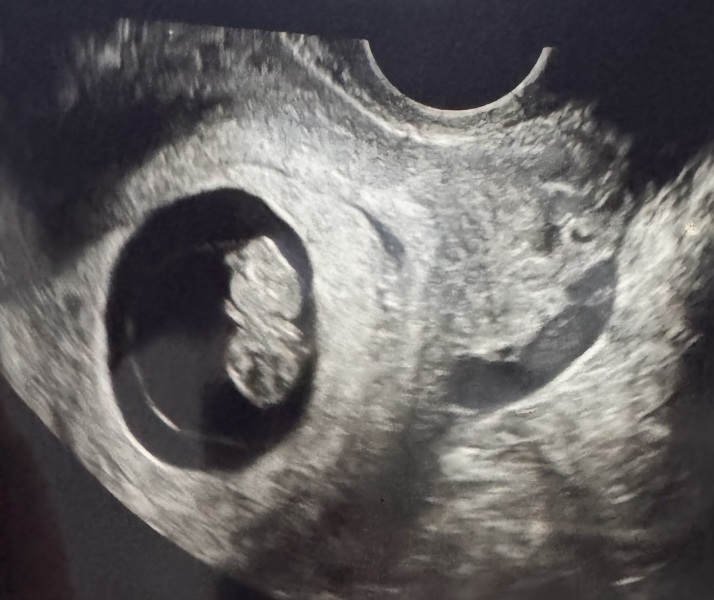 Any Mumma’s due in May 2027?