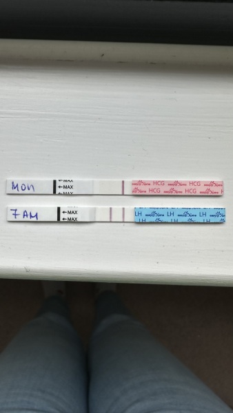 Early loss / MMC TTC support - the club nobody wanted to join 💔🌈