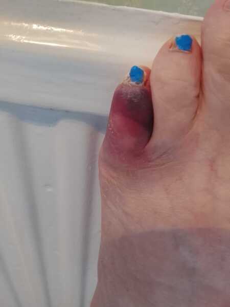 Does this toe look broken to you
