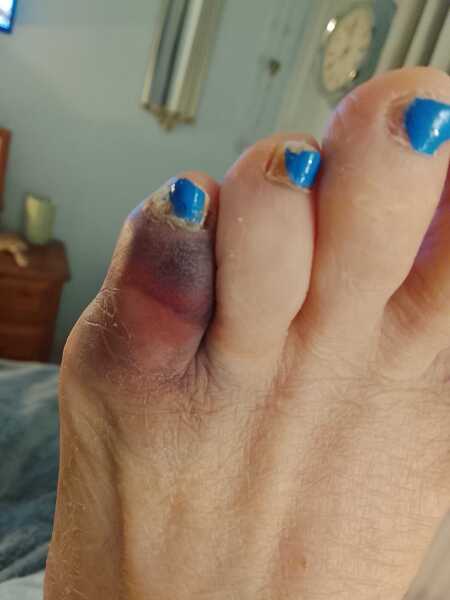 Does this toe look broken to you