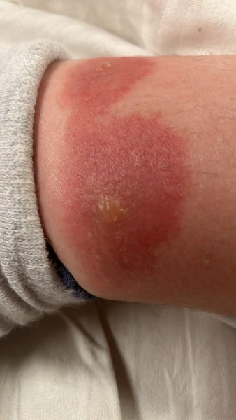 To see a GP for this?