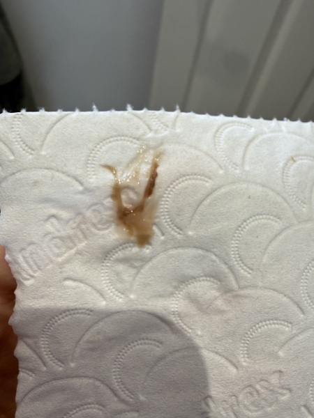 Start of a miscarriage? TW pictures