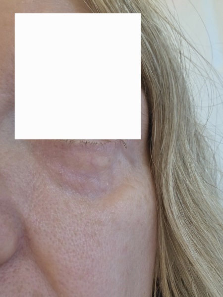 Help me fix my skin!