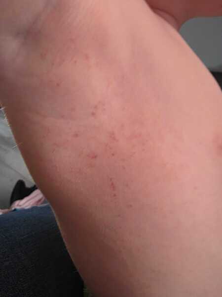Spots