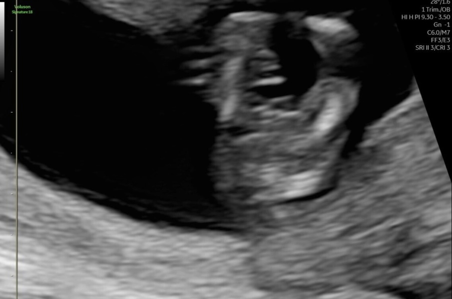 Potty shot - any ideas ?