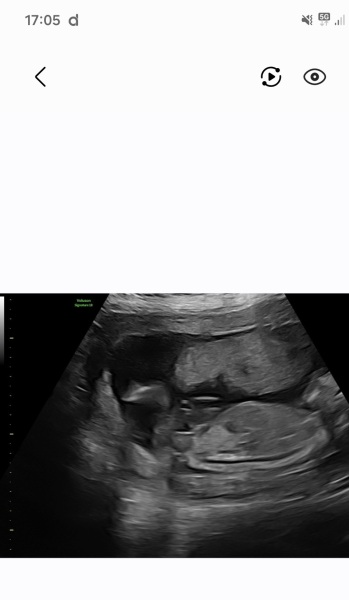 Gender scan guesses