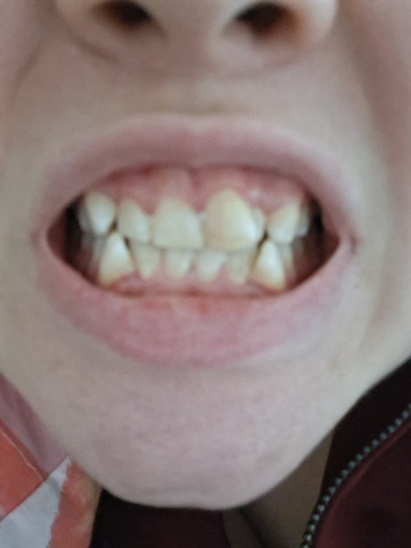 How shit are UK dentists