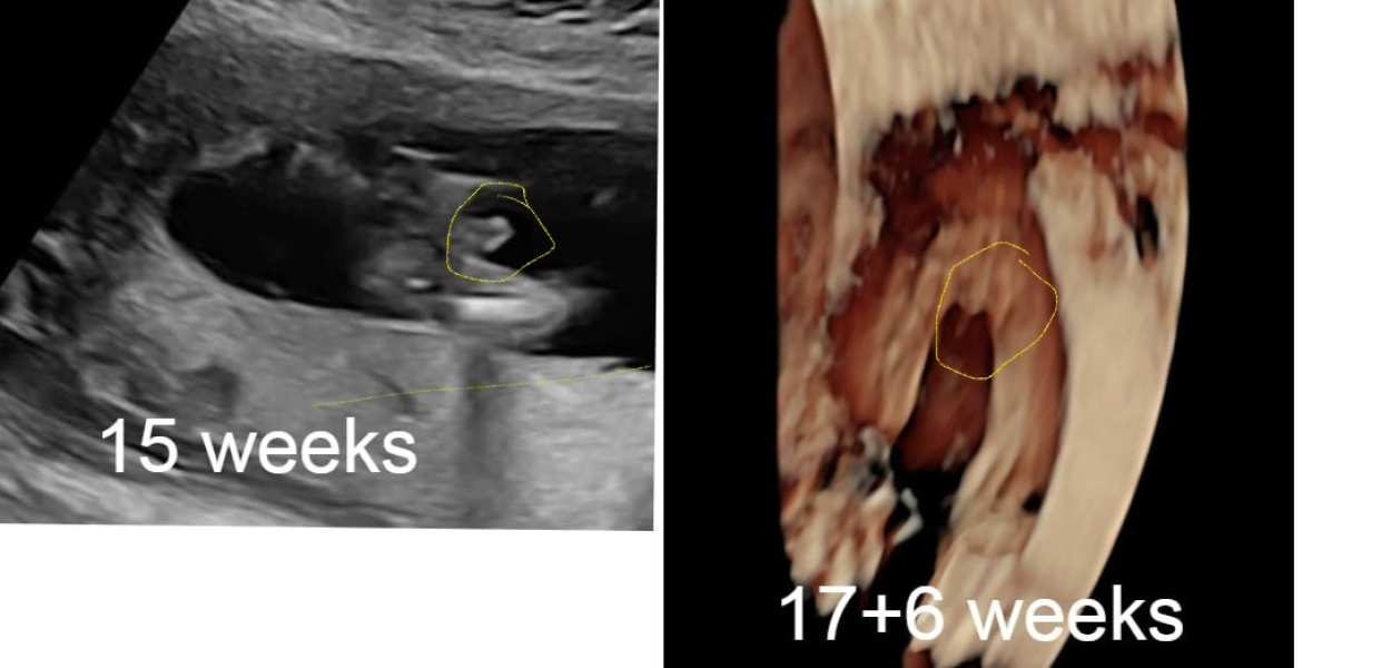 Can anyone guess whether my pregnancy might be a girl or boy?