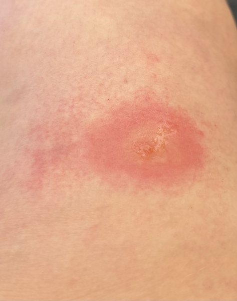 To see a GP for this?