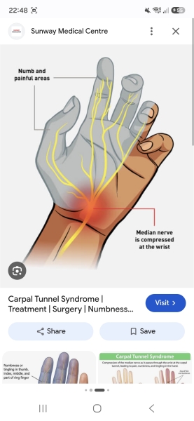 Dead, numb hands waking me up