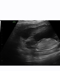 Gender scan guesses