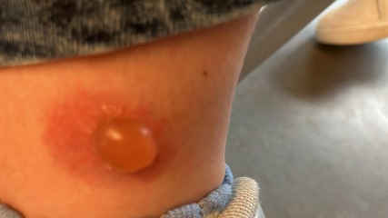 To see a GP for this?